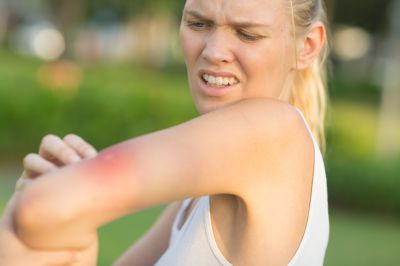 Prevent Wasp Stings!